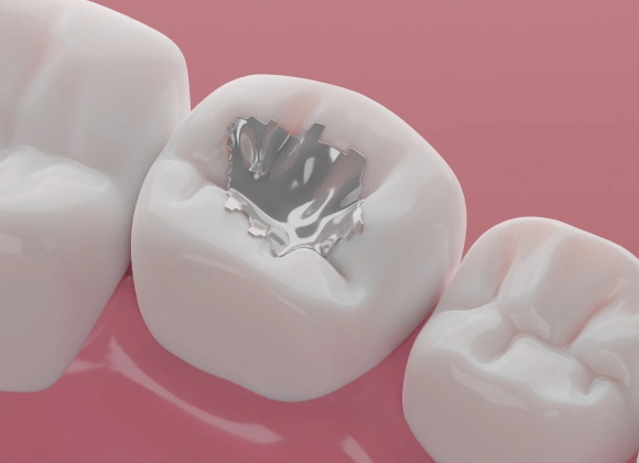 Three white dental crowns on pink background, one showing internal cavity structure detail.