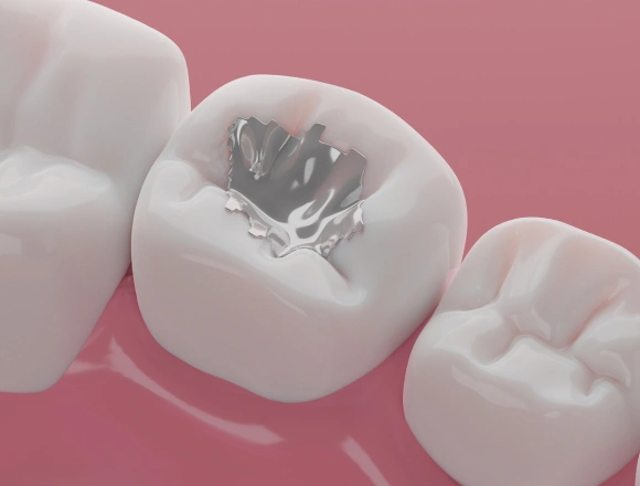 Three white teeth models on pink background, center tooth shows dark cavity damage for dental education.
