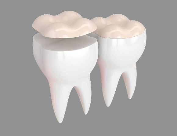 Two white teeth with dental crowns illustrated against gray background for dental care website.