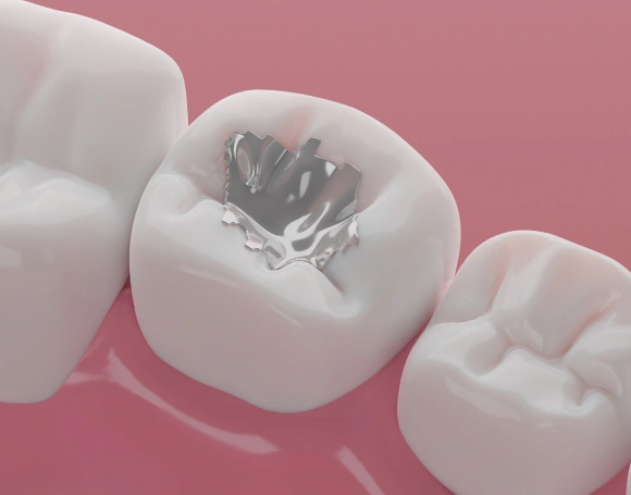 Three white dental crowns on pink background, center tooth showing internal structure detail.