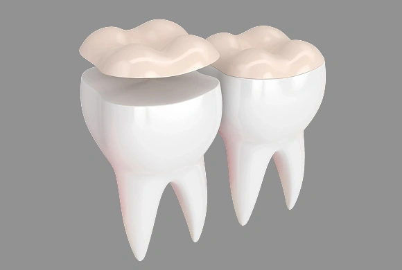 Two white teeth with beige crowns on gray background, representing dental crown treatment.