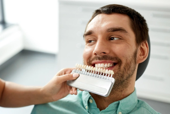 Man holding dental shade guide showing tooth color options in clinical setting.