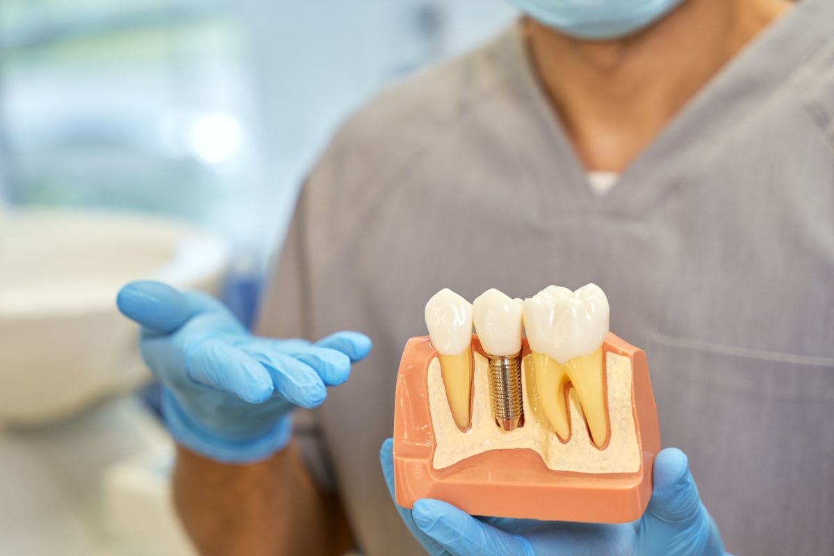 What can you eat after dental implants