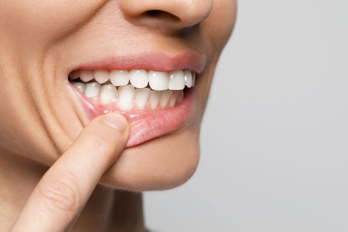 white spots on teeth enamel damage
